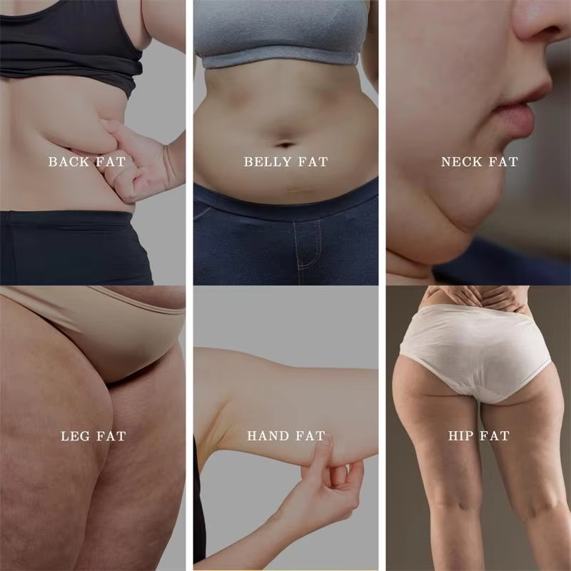 Herbal Belly Button Slimming P – Herbal Weight Bewertung und Preis